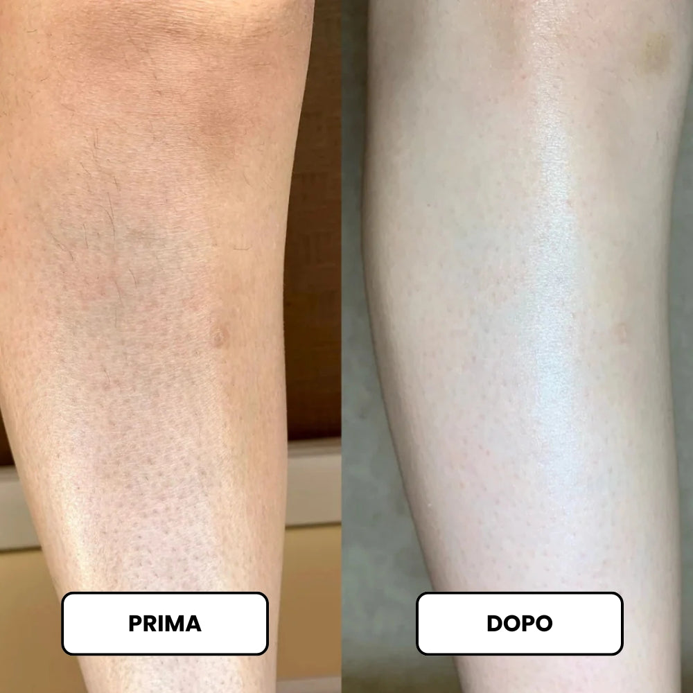 Crema Levigante a Tripla Azione per la Cheratosi Pilare